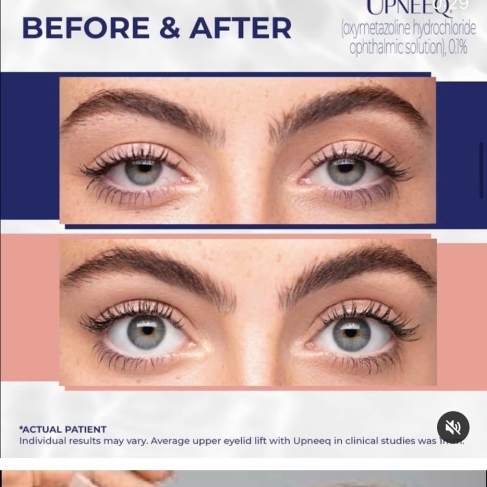 25 packages of OPNEEQ eye opening drops.